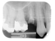 Periodical radiograph