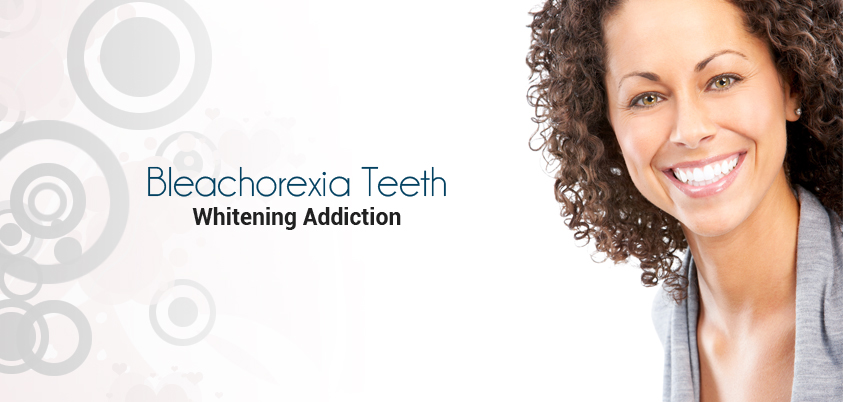 Bleachorexia a teeth whitening
