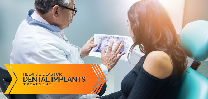 Dental implants treatment