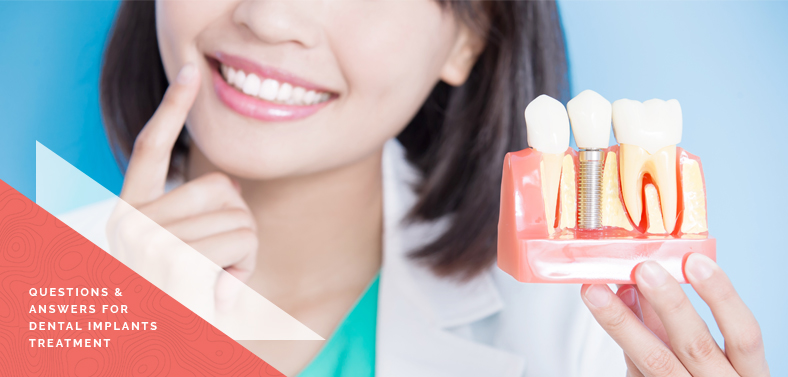 Questions and answers on dental implants