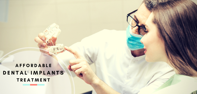 Affordable dental implants treatment