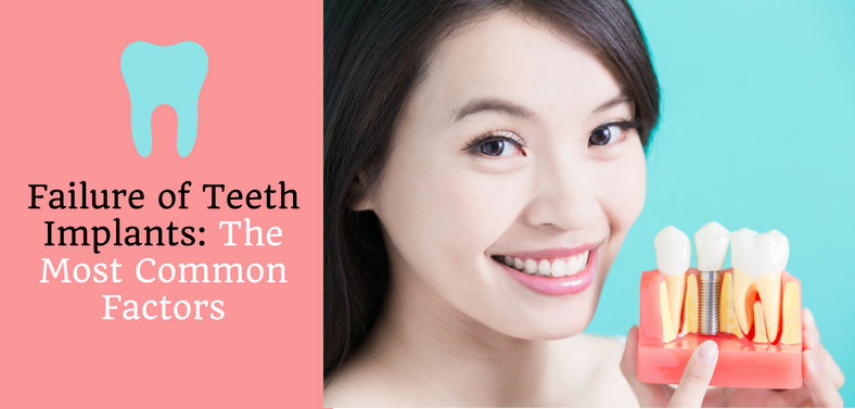 Failure of teeth implants