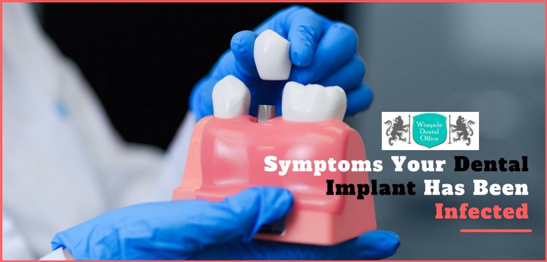 Symptoms of dental implants