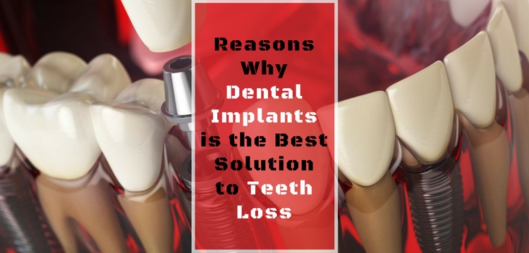Solution for teeth loss
