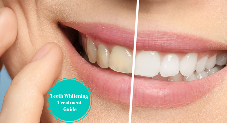 Teeth Whitening Treatment Guide