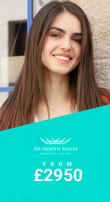 six month smile